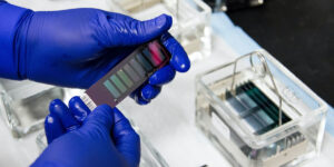 Read more about the article Fentanyl Vs Morphine: What is the difference? Which Opioid Is Stronger?